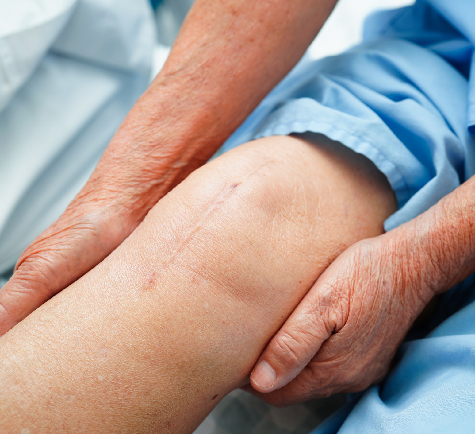 Total Knee Arthroplasty