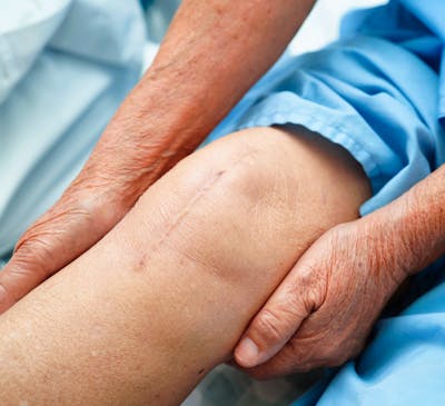 Total Knee Arthroplasty