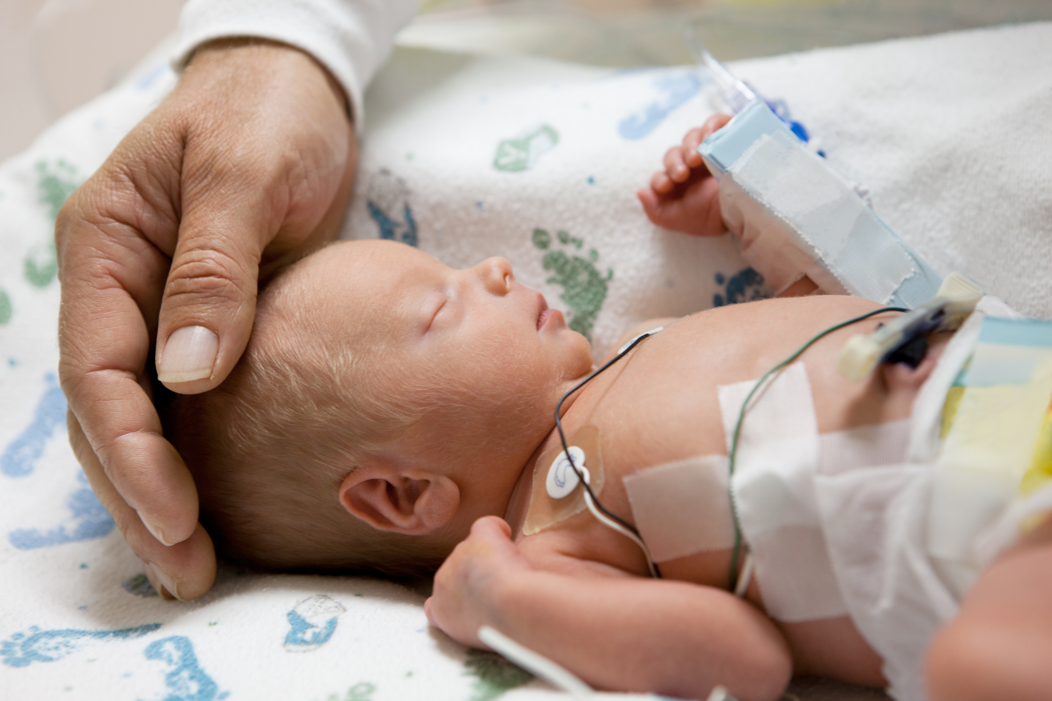 High-Risk Infants: Care from NICU to Home