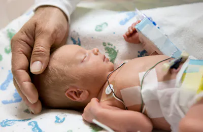 High-Risk Infants: Care from NICU to Home