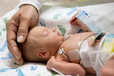 High-Risk Infants: Care from NICU to Home