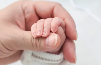 Transformative Strategies for Neonatal Abstinence Syndrome