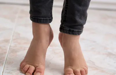 A Sensory-Based Approach to Pediatric Toe Walking