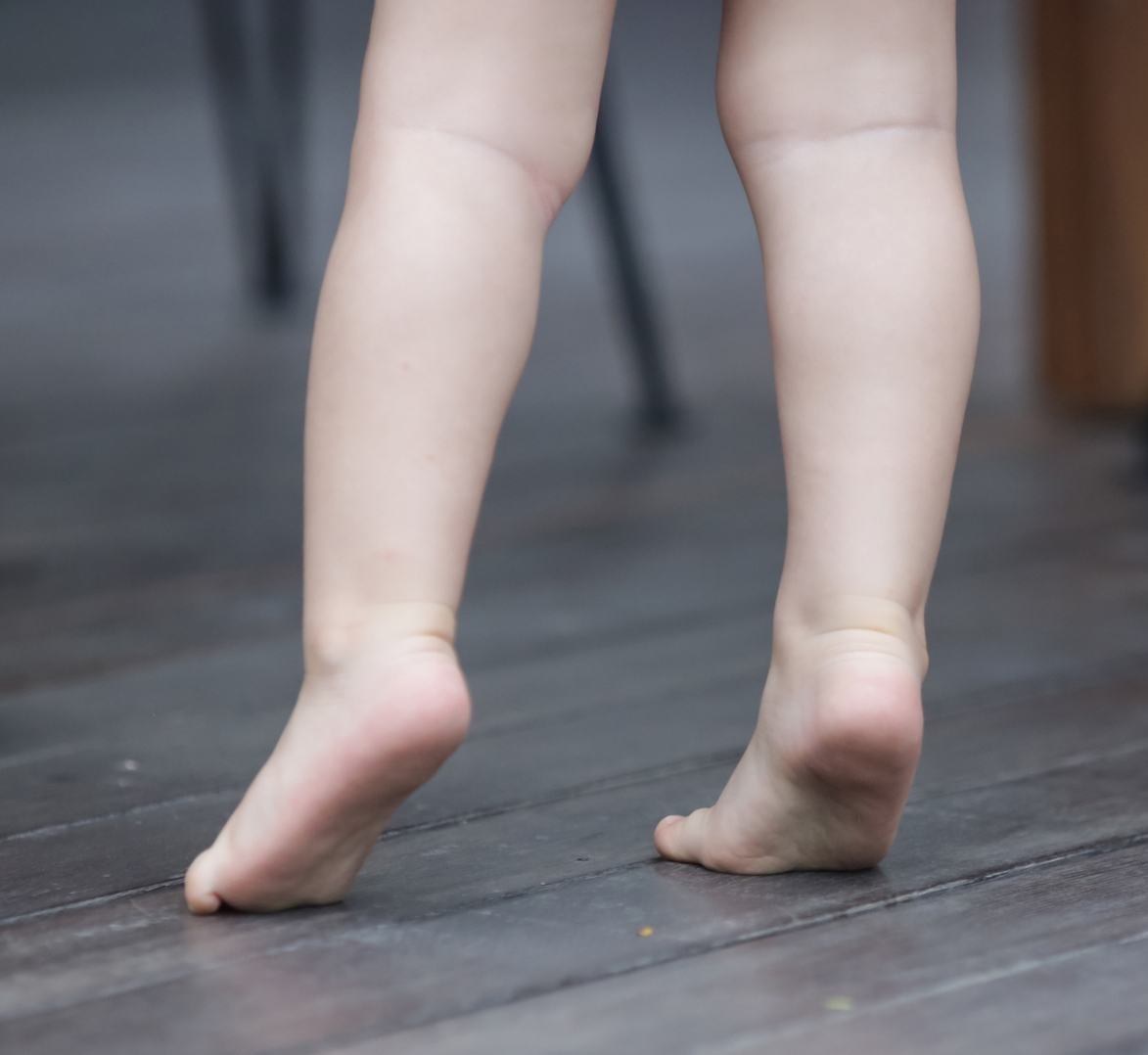 Differential Diagnosis of the Toe Walking Gait Pattern