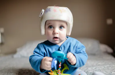 Treating Torticollis