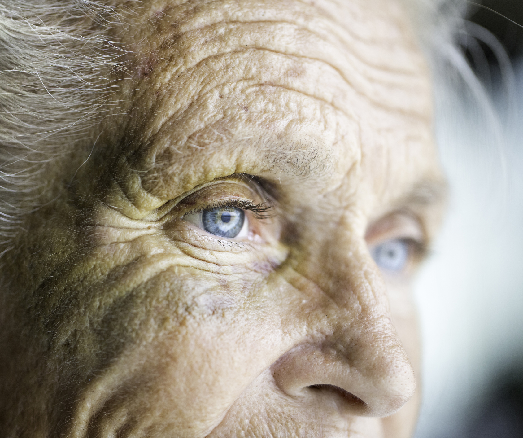 Examination and Treatment of Neglect in Stroke Patients