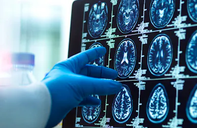 Tapping Neuroplasticity to Enhance Neurological Recovery