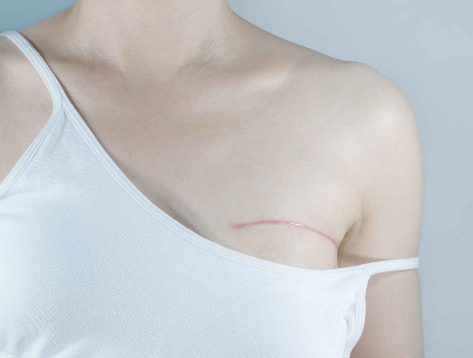 Comprehensive Scar Management Series Part II