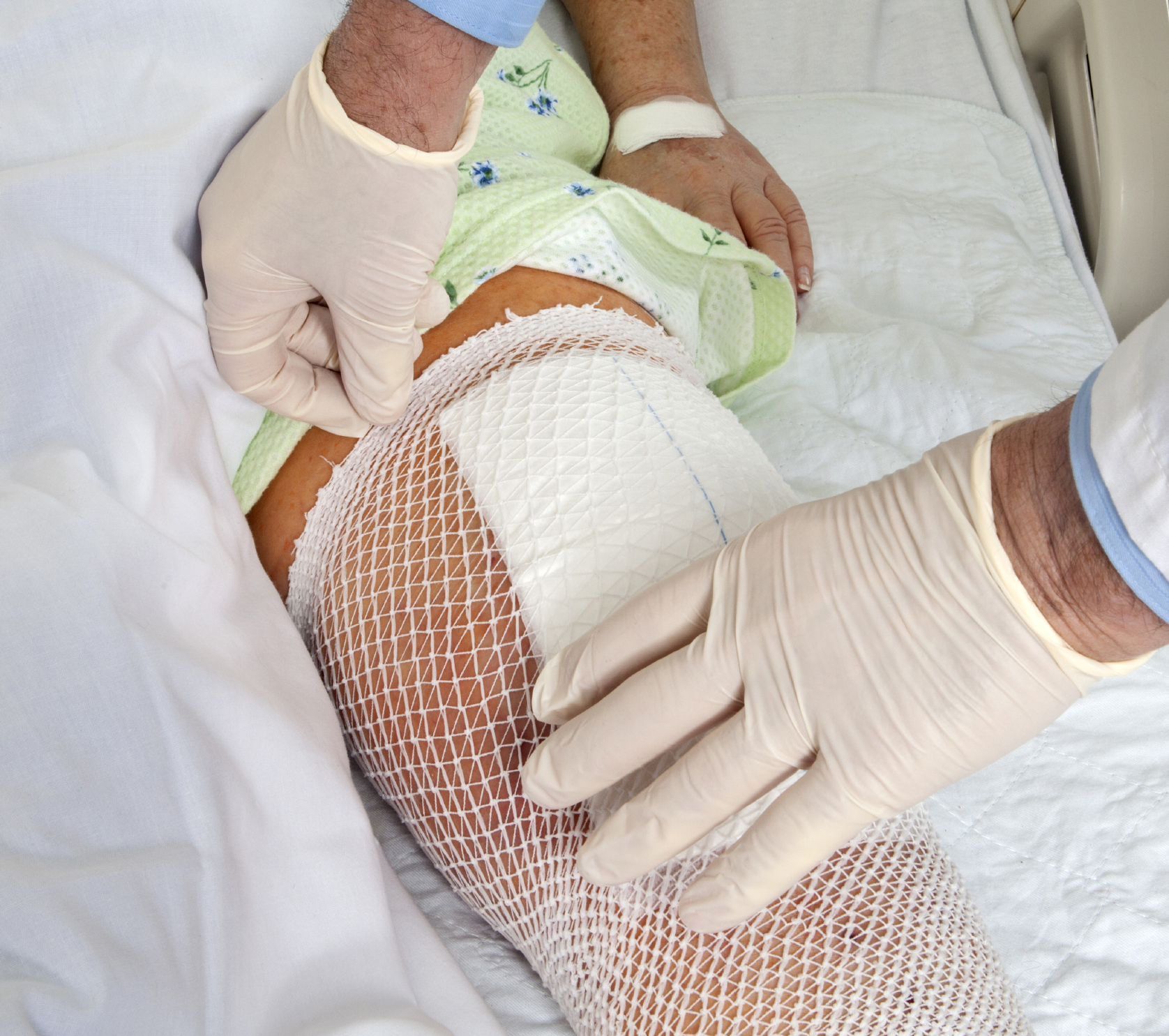 Evidence-Based Edema, Skin, and Wound Care