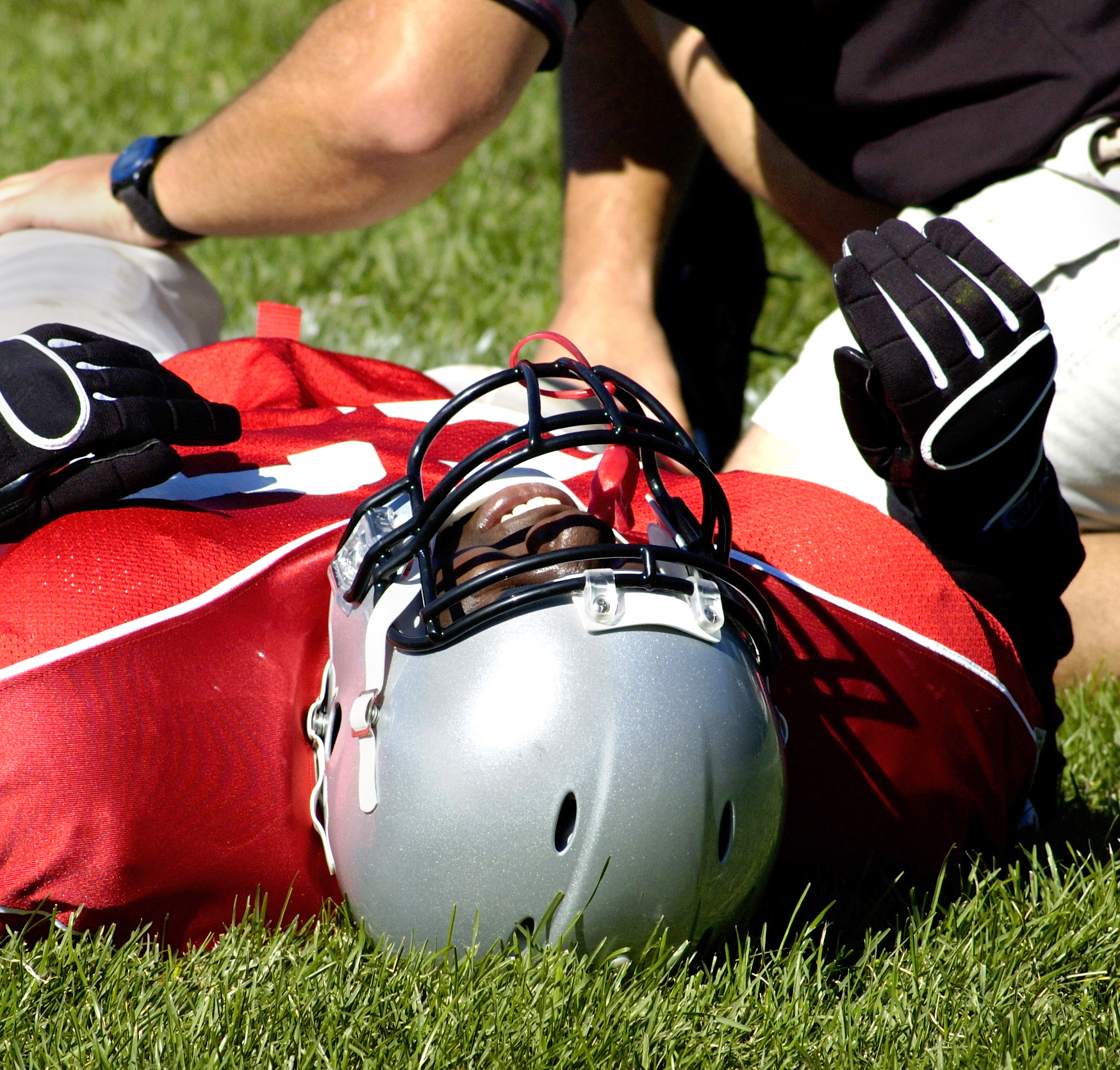 Concussion and Mild TBI