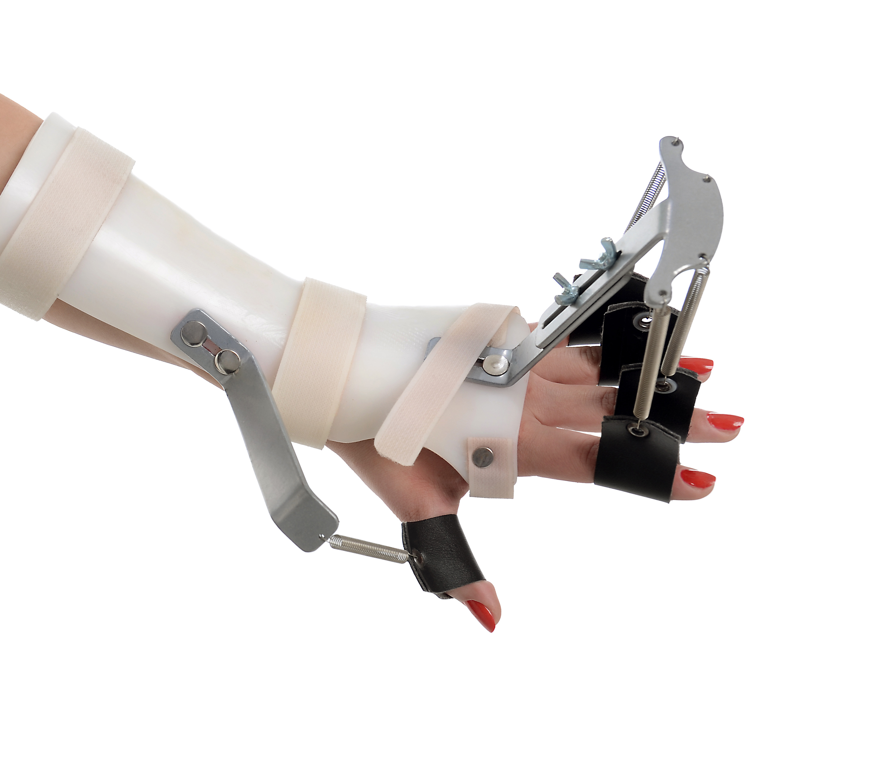 Dynamic Splinting for the Upper Extremity