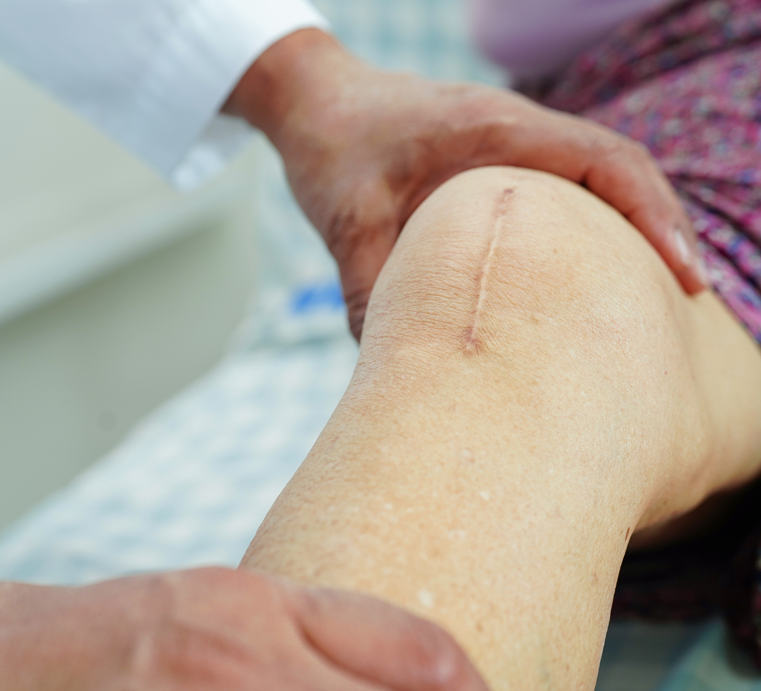 Total Joint Arthroplasty: Strategies for the First 72 Hours