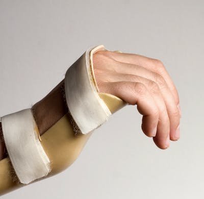 Common Orthotics for the Hand and Wrist