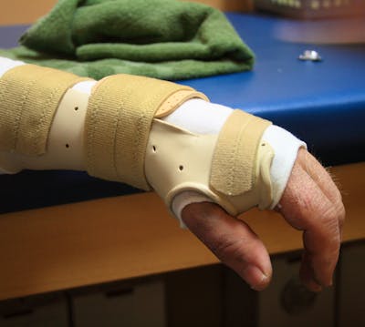 Static Splinting for Orthopedic and Neurological Conditions