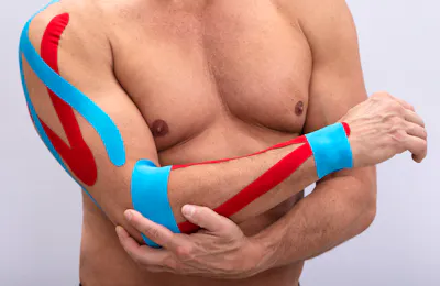 Therapeutic Taping Strategies for the Upper Extremity